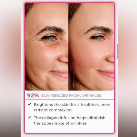 NIB Set of 3 - Glamory Micro-needling Micro Infusion Microlift System Skincare - Picture 11 of 16